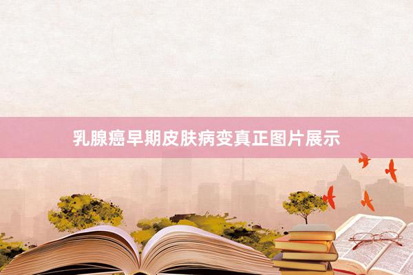 乳腺癌早期皮肤病变真正图片展示